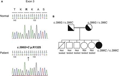 A Novel Homozygous Mutation of the AIRE Gene in an APECED Patient From Pakistan: Case Report and Review of the Literature